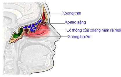 BỆNH VIÊM XOANG MÃN TÍNH